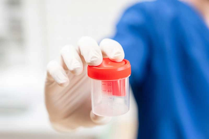 Drug and Alcohol Testing for CDL Drivers